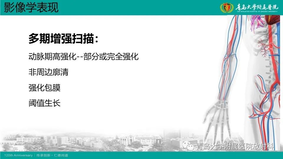 影像PPT - 【PPT】肝细胞癌-13