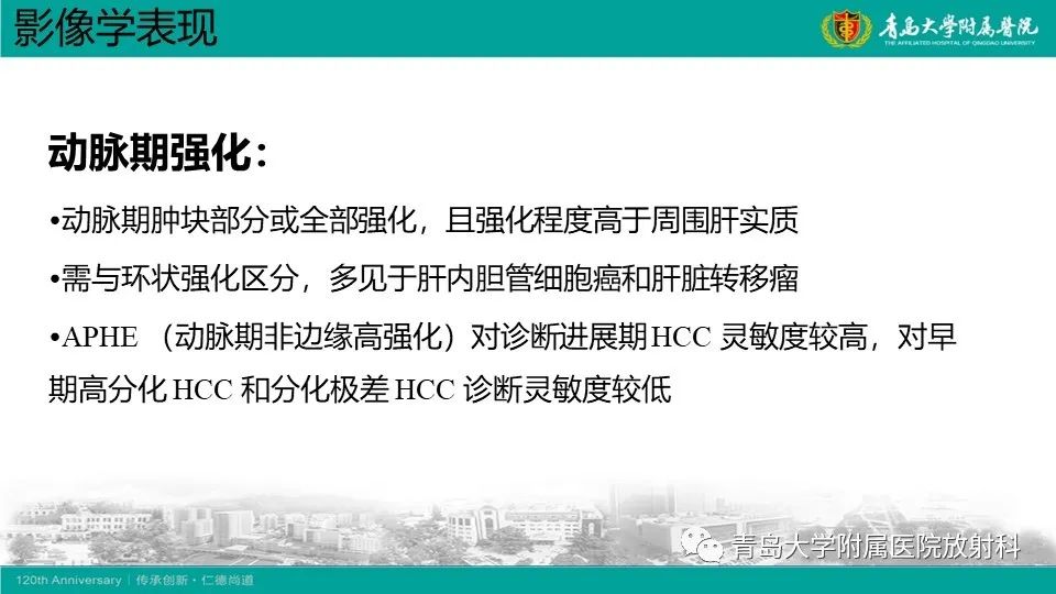 影像PPT - 【PPT】肝细胞癌-14