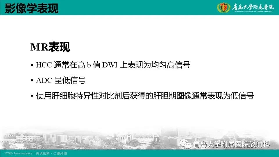 影像PPT - 【PPT】肝细胞癌-21