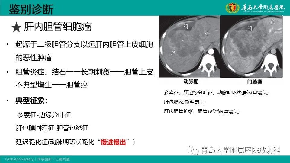 影像PPT - 【PPT】肝细胞癌-24