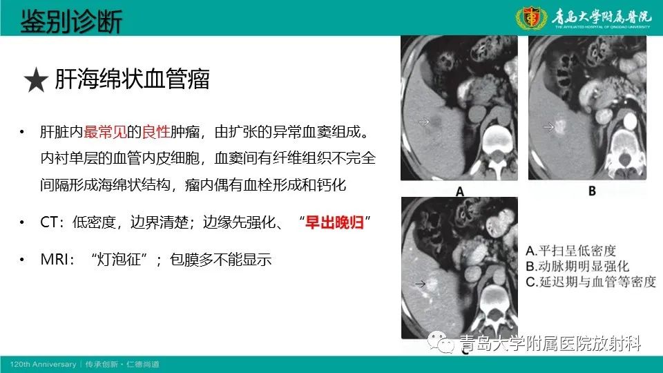 影像PPT - 【PPT】肝细胞癌-26