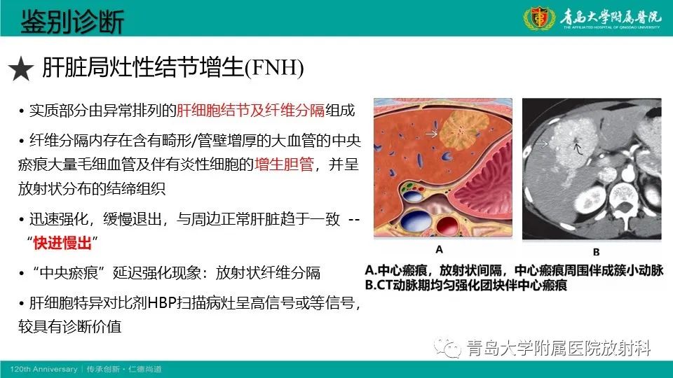 影像PPT - 【PPT】肝细胞癌-27