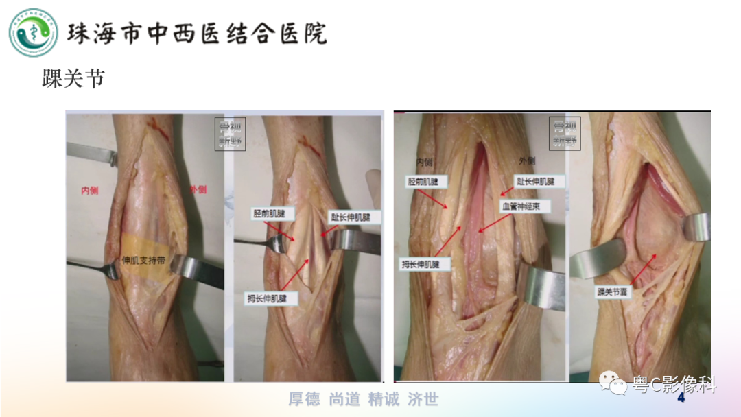 影像PPT - 【PPT】踝关节MRI扫描技术-4 影像PPT - 【PPT】踝关节MRI扫描技术-4
