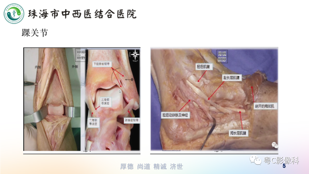 影像PPT - 【PPT】踝关节MRI扫描技术-5 影像PPT - 【PPT】踝关节MRI扫描技术-5