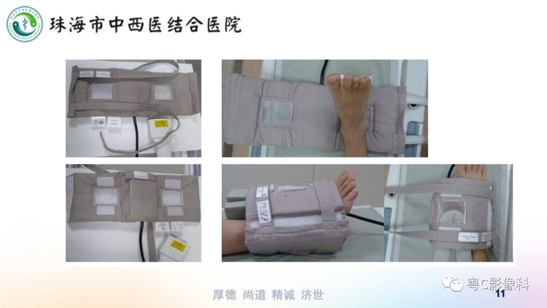 影像PPT - 【PPT】踝关节MRI扫描技术-11 影像PPT - 【PPT】踝关节MRI扫描技术-11