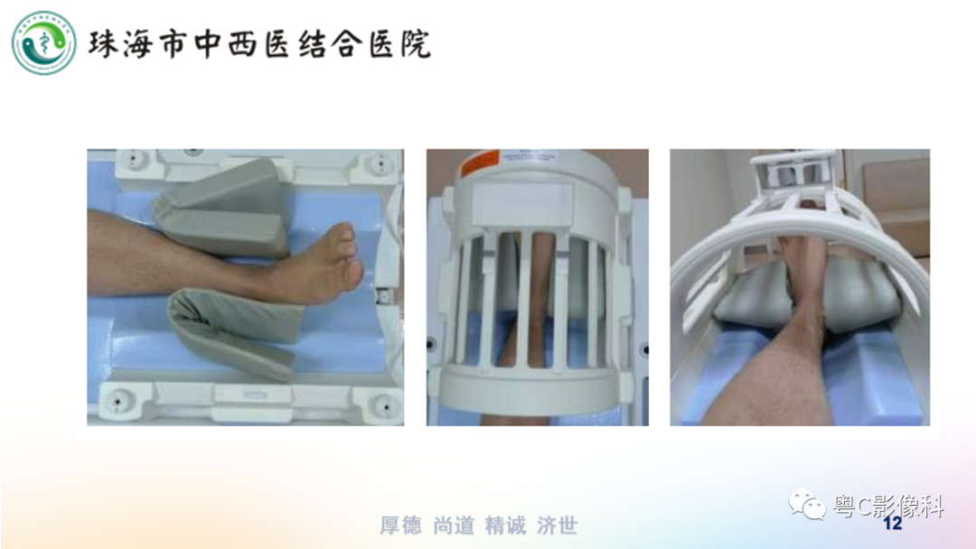 影像PPT - 【PPT】踝关节MRI扫描技术-12 影像PPT - 【PPT】踝关节MRI扫描技术-12