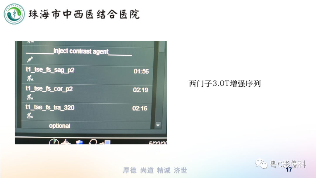 影像PPT - 【PPT】踝关节MRI扫描技术-17 影像PPT - 【PPT】踝关节MRI扫描技术-17