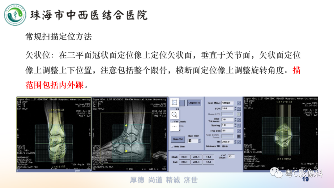 影像PPT - 【PPT】踝关节MRI扫描技术-19 影像PPT - 【PPT】踝关节MRI扫描技术-19
