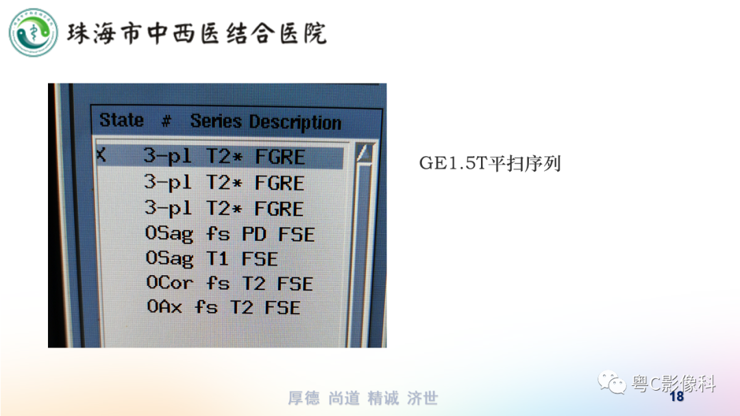 影像PPT - 【PPT】踝关节MRI扫描技术-18 影像PPT - 【PPT】踝关节MRI扫描技术-18