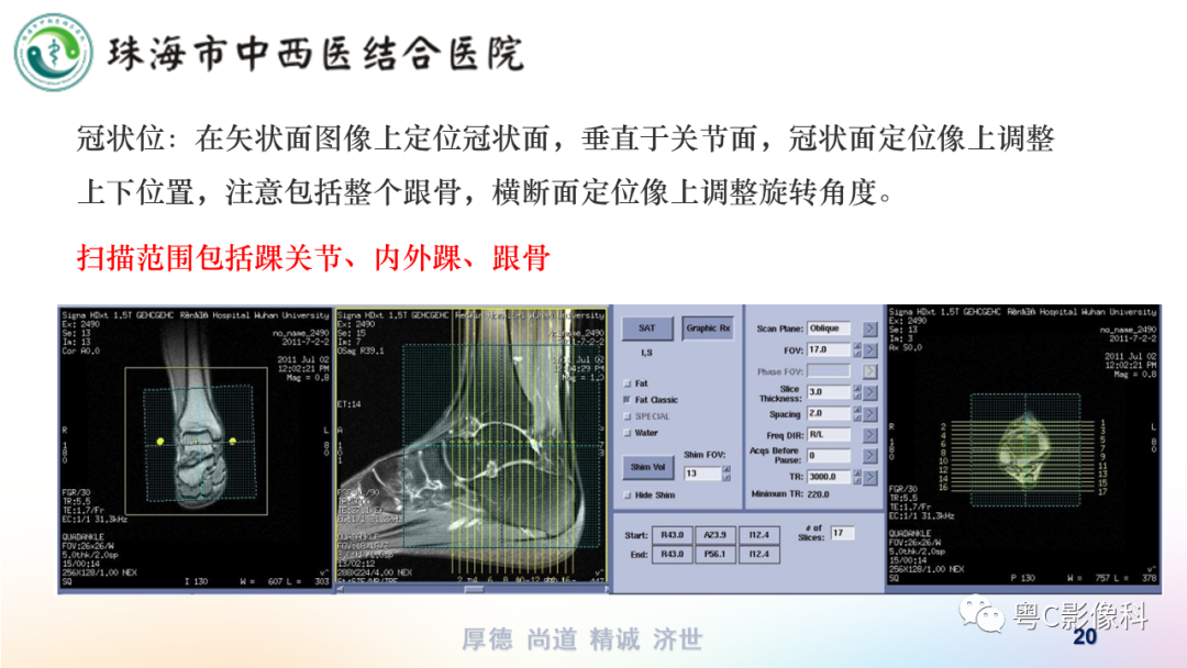 影像PPT - 【PPT】踝关节MRI扫描技术-20 影像PPT - 【PPT】踝关节MRI扫描技术-20