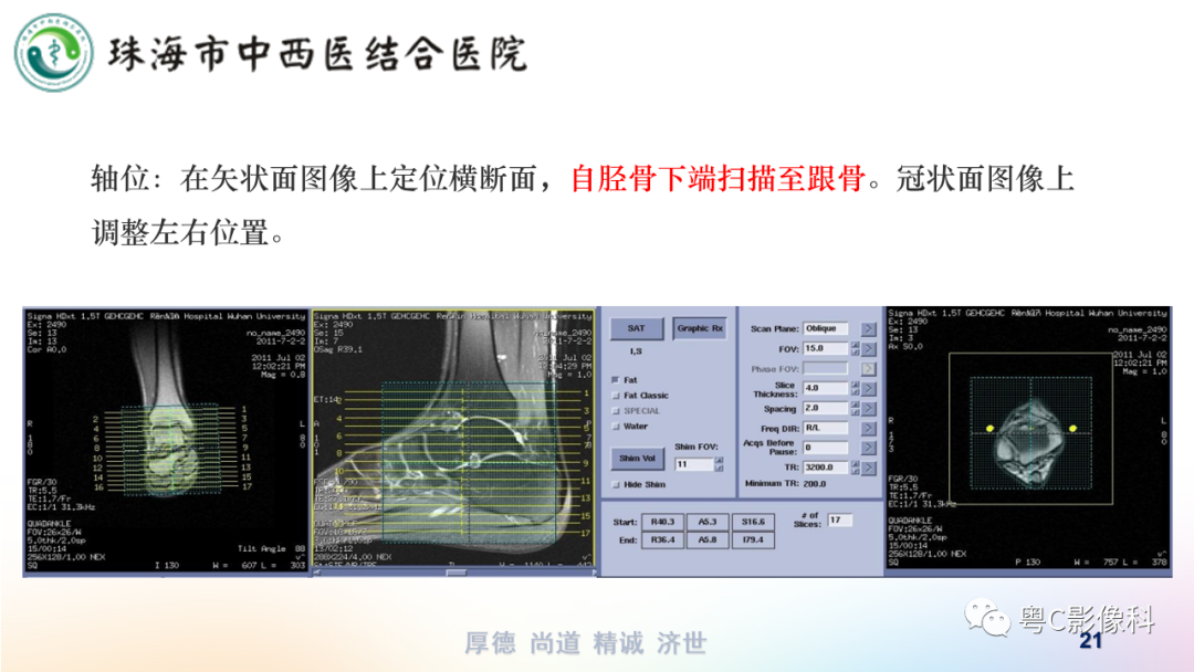 影像PPT - 【PPT】踝关节MRI扫描技术-21 影像PPT - 【PPT】踝关节MRI扫描技术-21