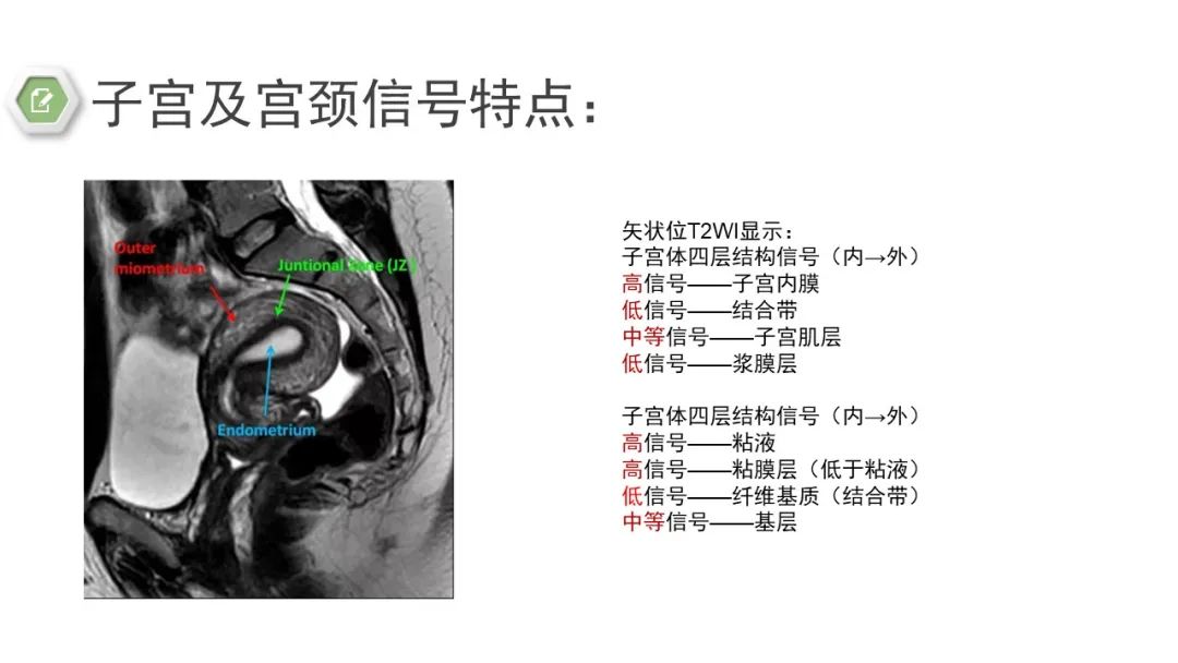 影像PPT - 【病例】子宫内膜癌1例MR影像-33 影像PPT - 【病例】子宫内膜癌1例MR影像-33