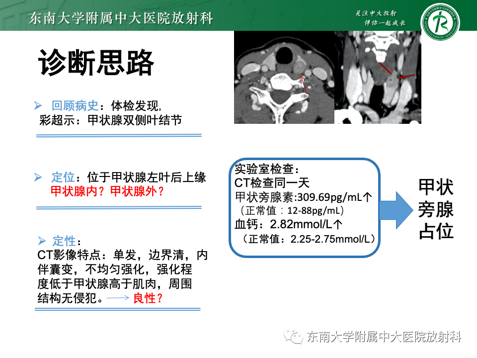 影像PPT - 【PPT】甲状旁腺病变-2
