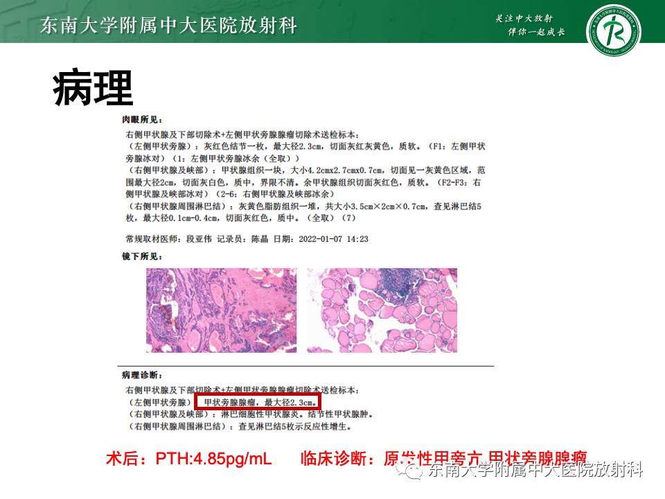 影像PPT - 【PPT】甲状旁腺病变-3