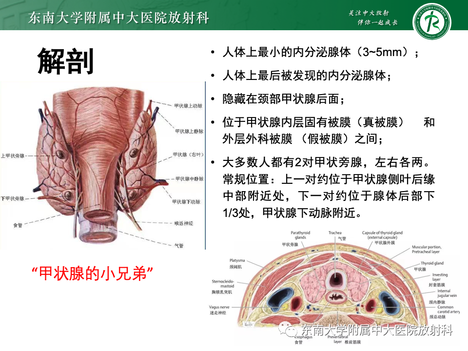 影像PPT - 【PPT】甲状旁腺病变-6