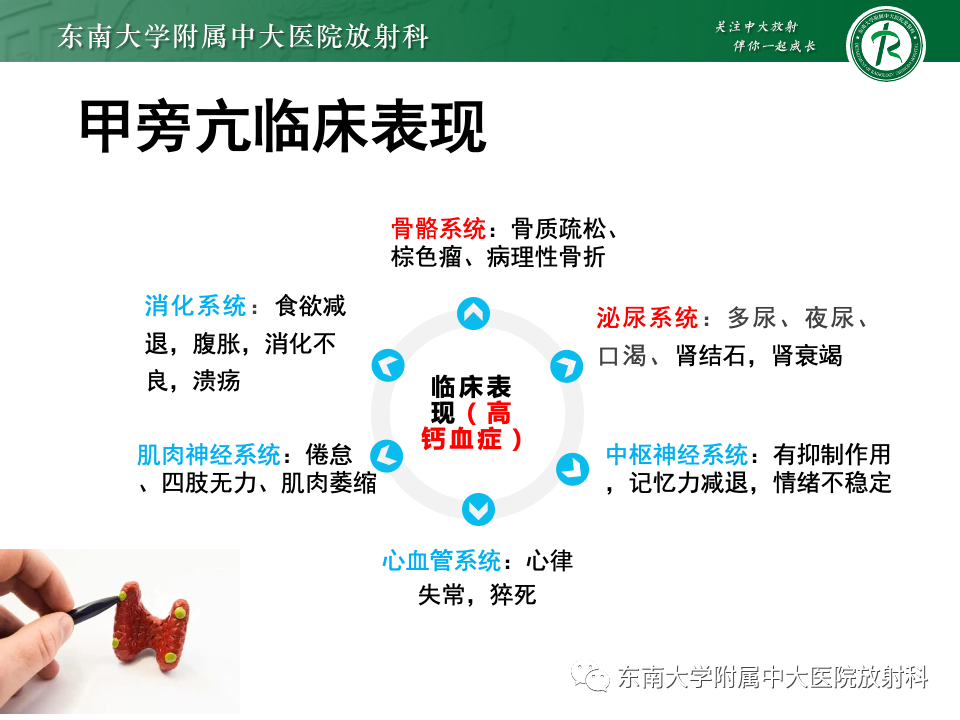 影像PPT - 【PPT】甲状旁腺病变-10