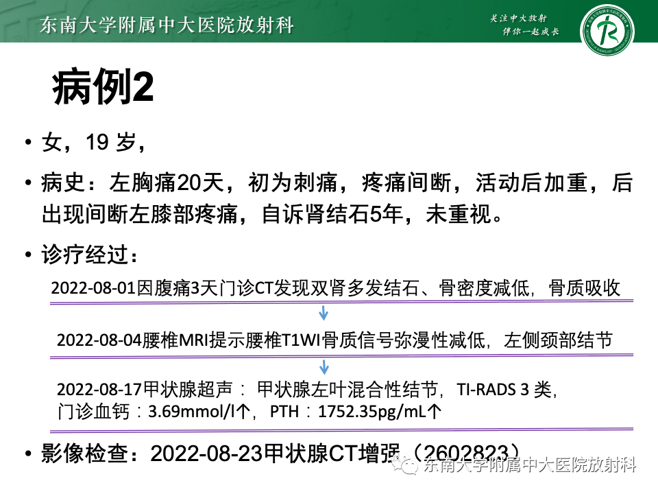 影像PPT - 【PPT】甲状旁腺病变-17