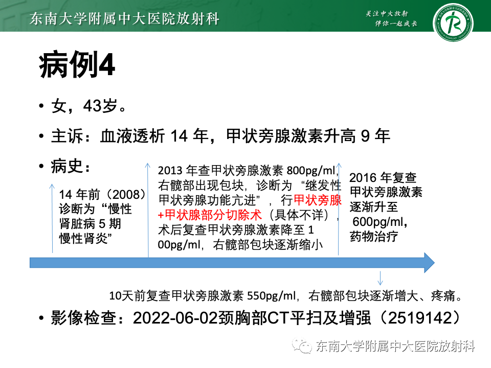 影像PPT - 【PPT】甲状旁腺病变-24