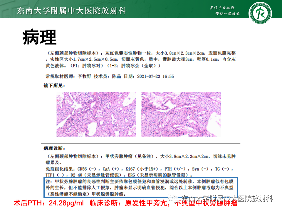 影像PPT - 【PPT】甲状旁腺病变-23