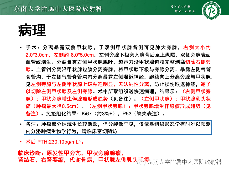 影像PPT - 【PPT】甲状旁腺病变-30