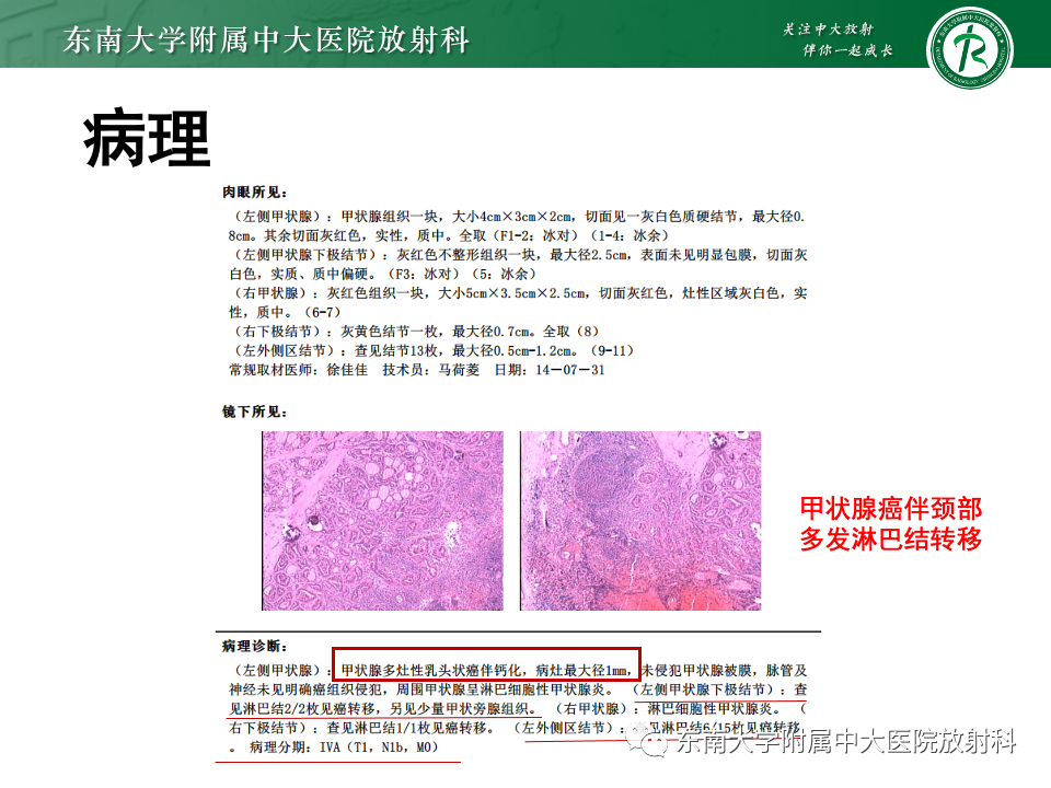 影像PPT - 【PPT】甲状旁腺病变-46