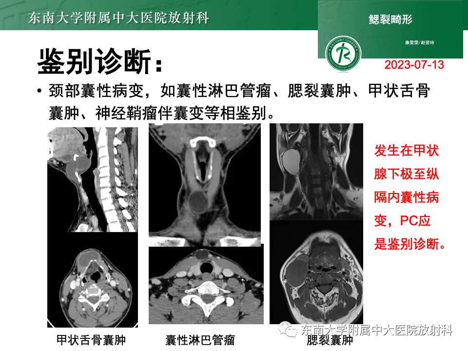 影像PPT - 【PPT】甲状旁腺病变-50
