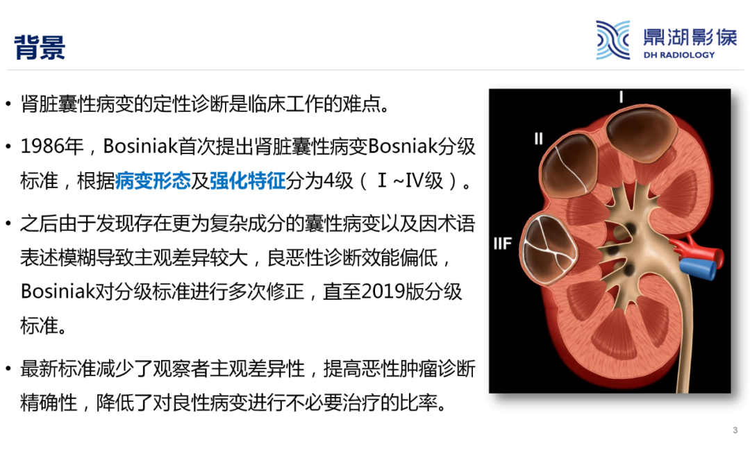 影像PPT - 【PPT】肾脏囊性病变Bosniak分级-3 影像PPT - 【PPT】肾脏囊性病变Bosniak分级-3