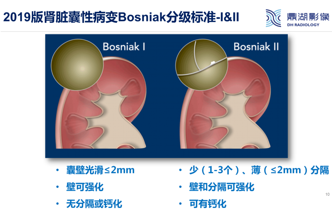 影像PPT - 【PPT】肾脏囊性病变Bosniak分级-10 影像PPT - 【PPT】肾脏囊性病变Bosniak分级-10
