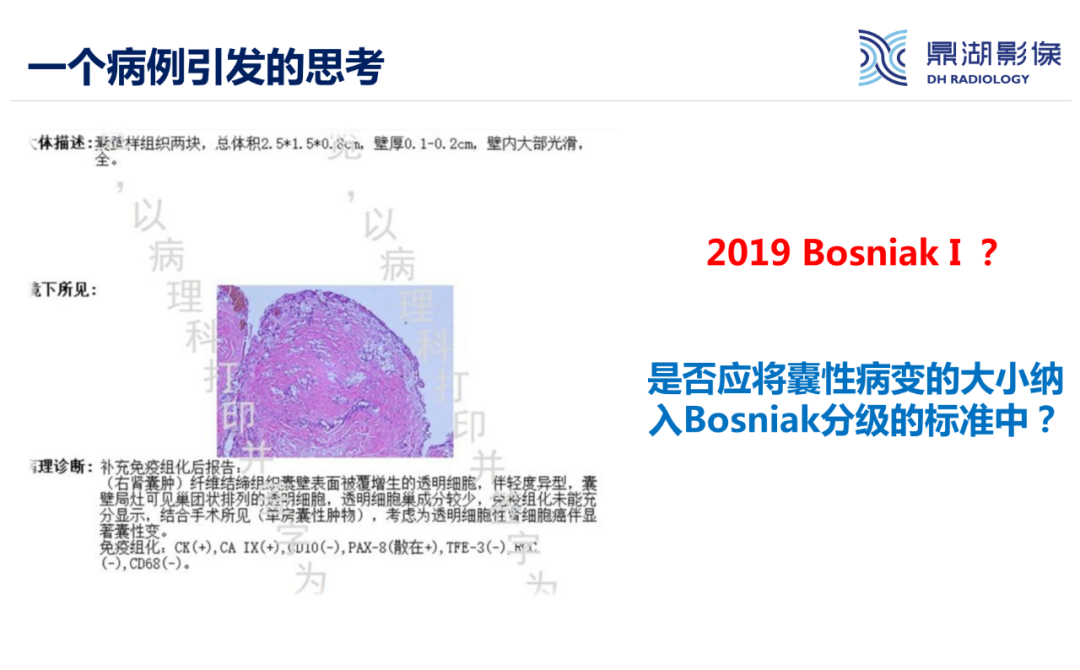 影像PPT - 【PPT】肾脏囊性病变Bosniak分级-31 影像PPT - 【PPT】肾脏囊性病变Bosniak分级-31