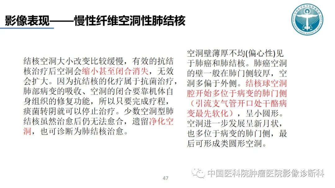 影像PPT - 【PPT】肺结核-47