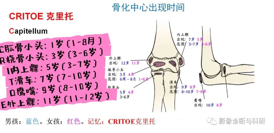 影像PPT - 儿童肘关节脱位的几个关键要点-11 影像PPT - 儿童肘关节脱位的几个关键要点-11