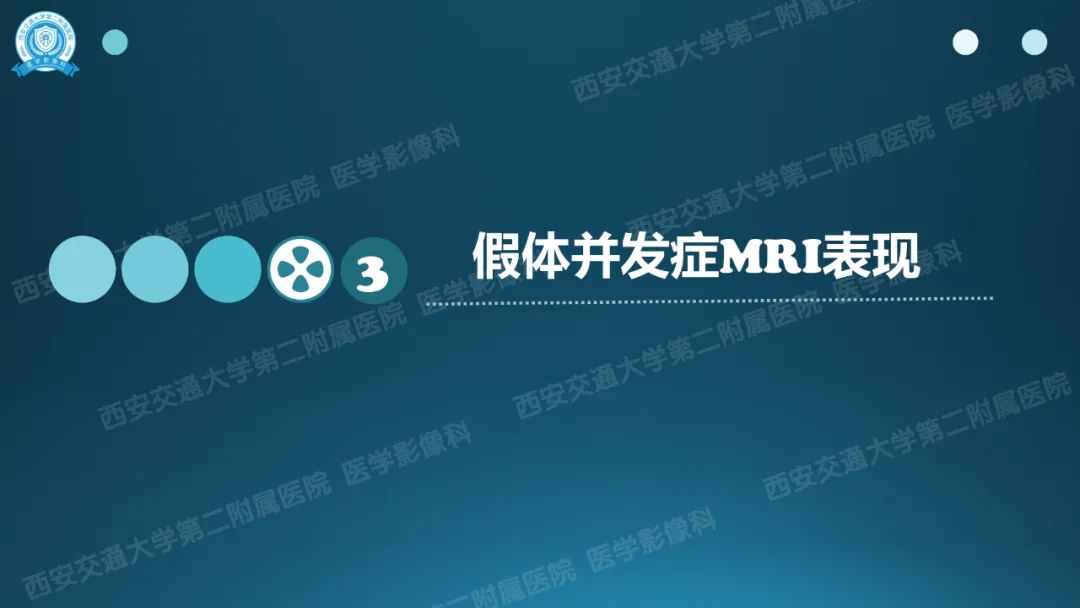 影像PPT - 【PPT】乳腺假体植入的MRI评估-14