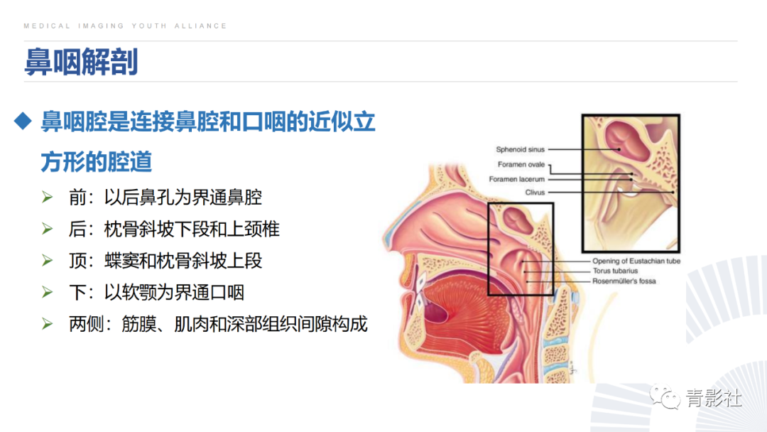 影像PPT - 【PPT】鼻咽癌周围结构侵犯的影像诊断思路-4