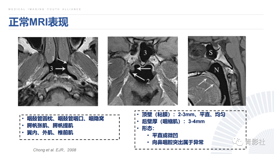 影像PPT - 【PPT】鼻咽癌周围结构侵犯的影像诊断思路-9