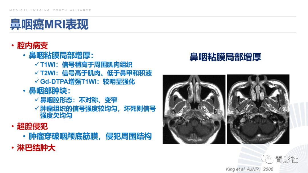 影像PPT - 【PPT】鼻咽癌周围结构侵犯的影像诊断思路-16