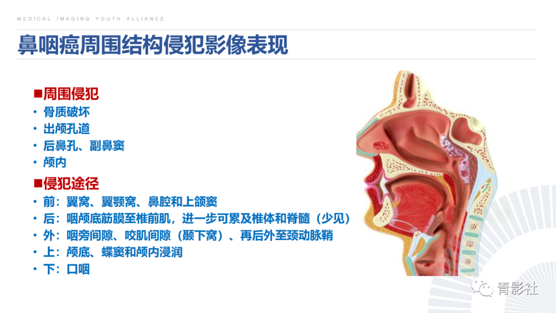 影像PPT - 【PPT】鼻咽癌周围结构侵犯的影像诊断思路-18