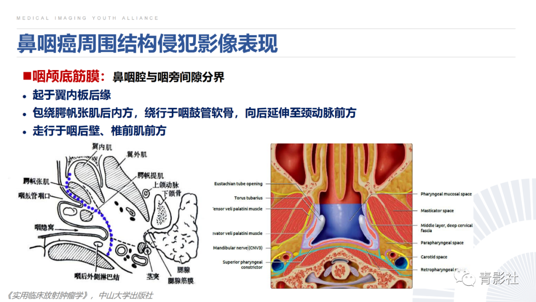 影像PPT - 【PPT】鼻咽癌周围结构侵犯的影像诊断思路-21