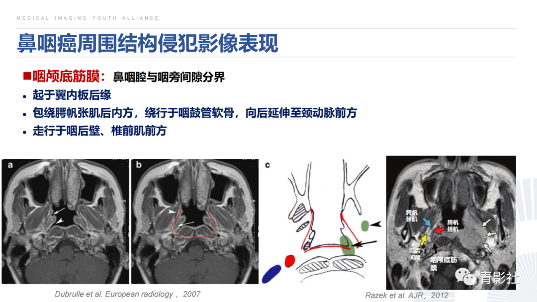 影像PPT - 【PPT】鼻咽癌周围结构侵犯的影像诊断思路-22