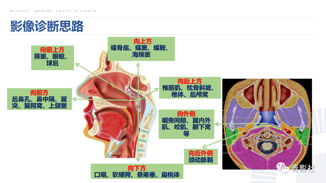 影像PPT - 【PPT】鼻咽癌周围结构侵犯的影像诊断思路-34