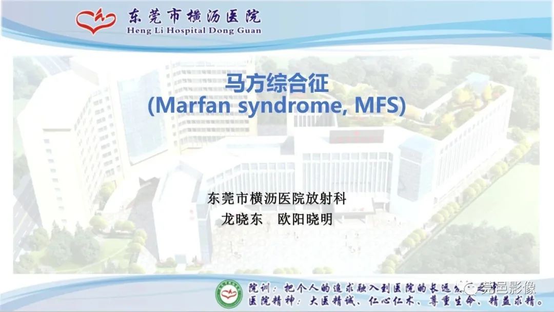 影像PPT - 【PPT】马方综合征-1