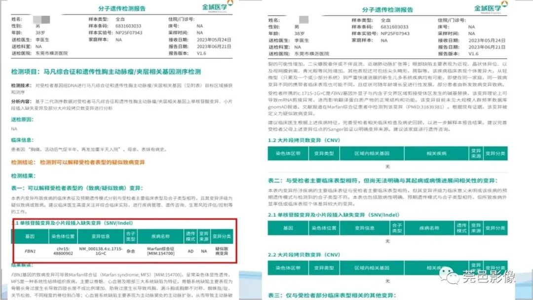 影像PPT - 【PPT】马方综合征-6
