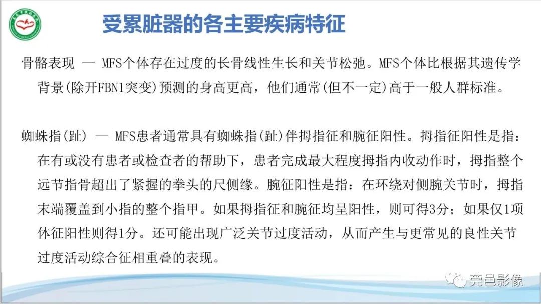 影像PPT - 【PPT】马方综合征-13