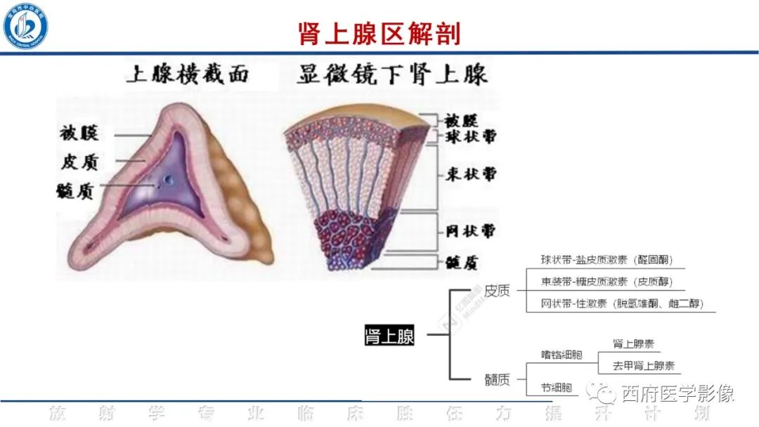影像PPT - 【PPT】肾上腺大结节样增生影像诊断-10