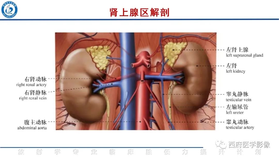 影像PPT - 【PPT】肾上腺大结节样增生影像诊断-11
