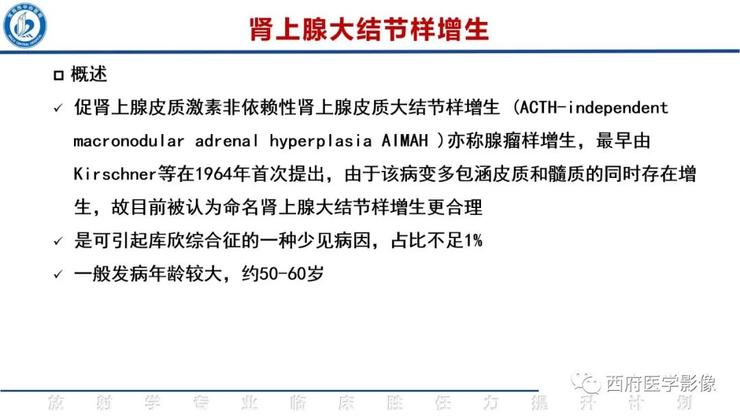 影像PPT - 【PPT】肾上腺大结节样增生影像诊断-12