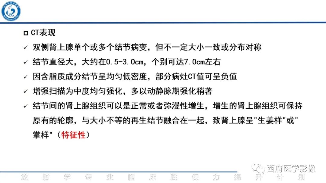 影像PPT - 【PPT】肾上腺大结节样增生影像诊断-16