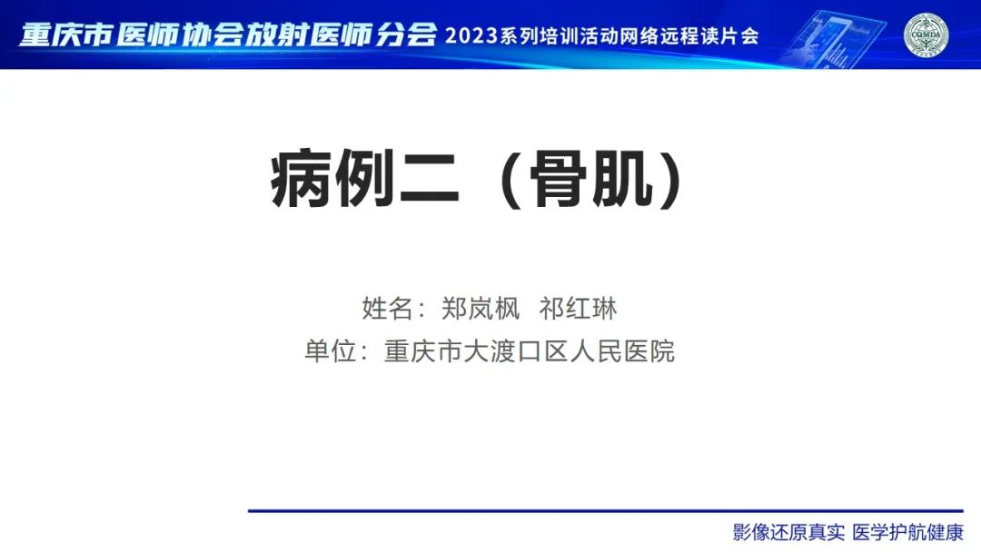影像PPT - 【病例】大腿黏液纤维肉瘤1例MR影像-1