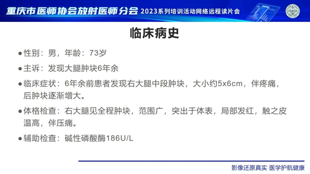 影像PPT - 【病例】大腿黏液纤维肉瘤1例MR影像-2