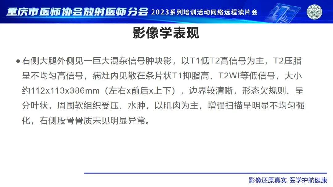 影像PPT - 【病例】大腿黏液纤维肉瘤1例MR影像-3