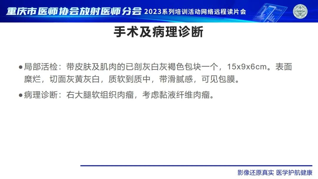 影像PPT - 【病例】大腿黏液纤维肉瘤1例MR影像-7